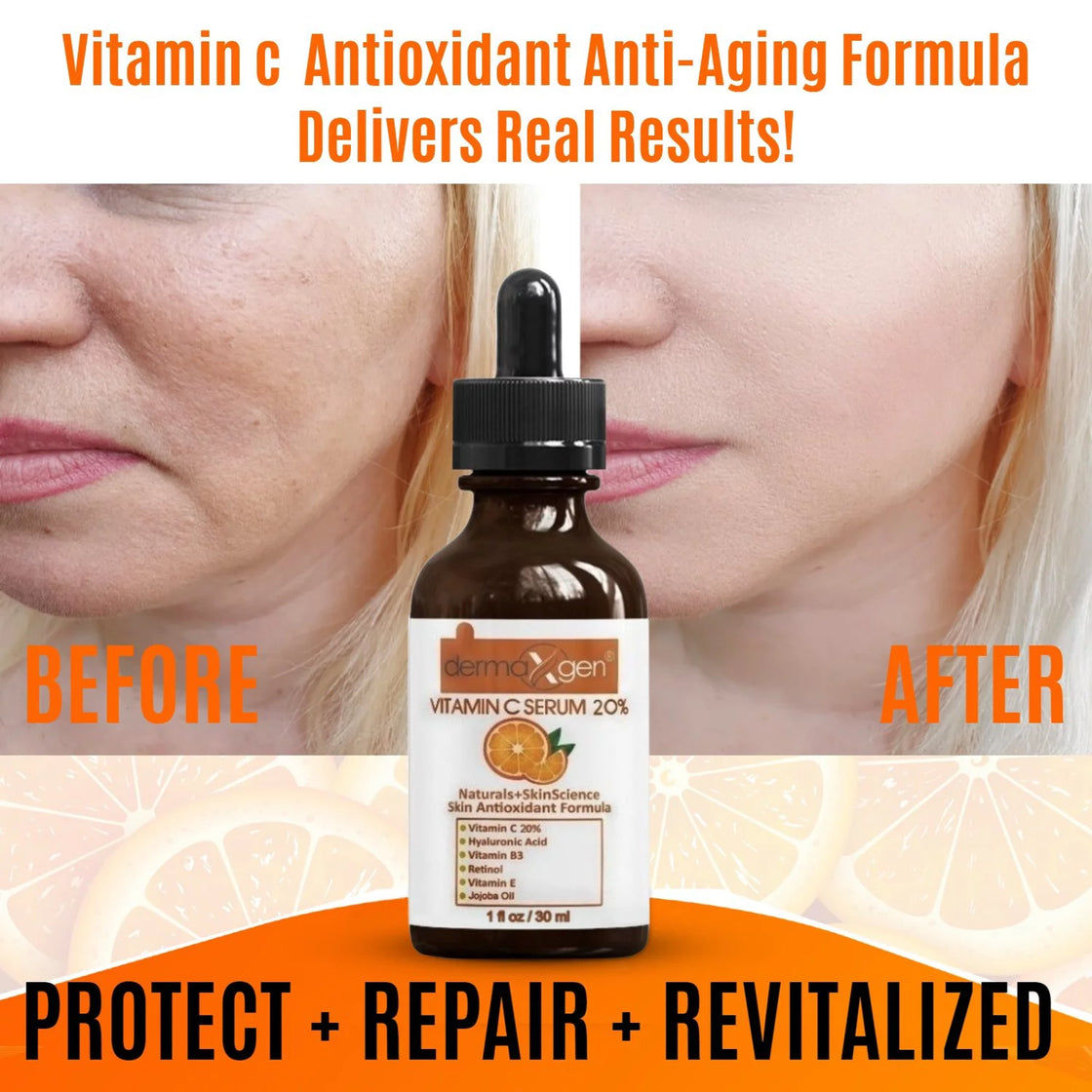 Pure Vitamin C 20% Anti Aging Serum, Hyaluronic Acid, Vitamin A and Vitamin E Anti wrinkle rejuvenator- 2 fl oz