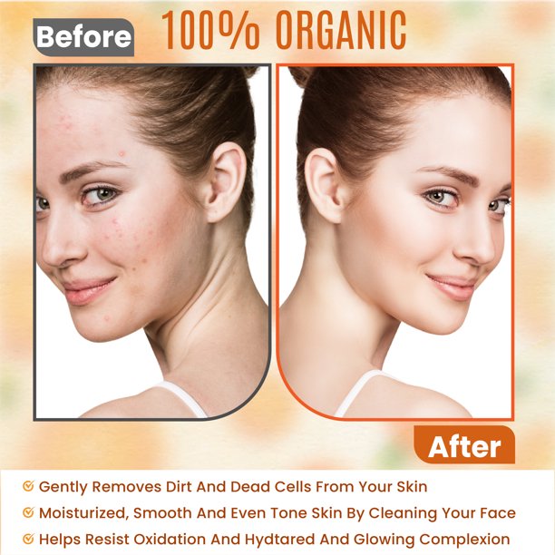 Vitamin C Facial Cleanser - DEEP SKIN CLEANSING FORMULA - Anti Aging, Breakout & Blemish, Wrinkle Reducing - Clear Pores For OILY/NORMALSKIN Organic & Natural Ingredients