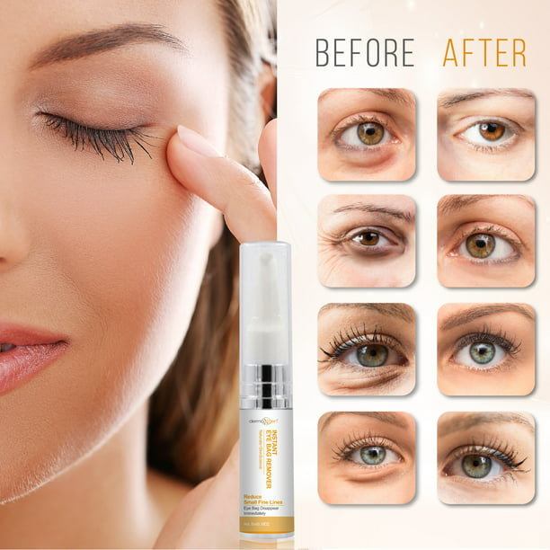 INSTANT EYEBAG REMOVER Anti Aging Reduce Dark Circles, Puffiness, Eye Bags, Wrinkles DERMAXGEN