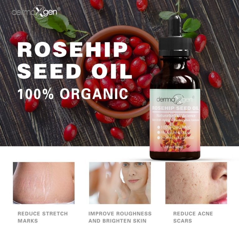 ROSEHIP SEED OIL 8 fl oz -100% Organic & Cold Pressed - Anti-Aging Moisturizing Treatment for Face, Hair, Skin & Nails, Acne Scars, Anti-Wrinkle